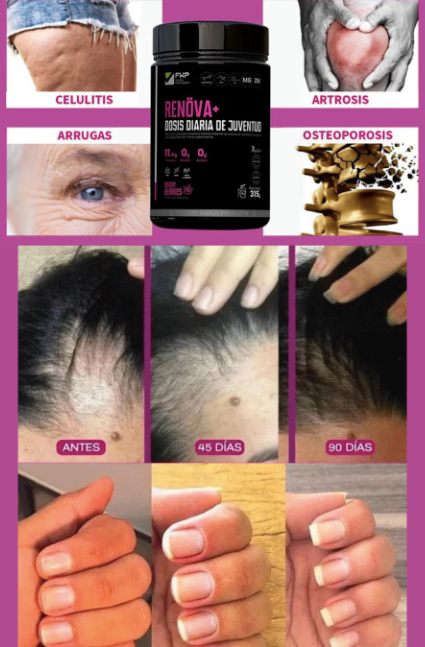 RENOVA+ - Tu dosis diaria de juventud
