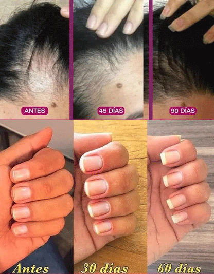 COLÁGENO RENOVA PLUS - Dosis diaria de juventud